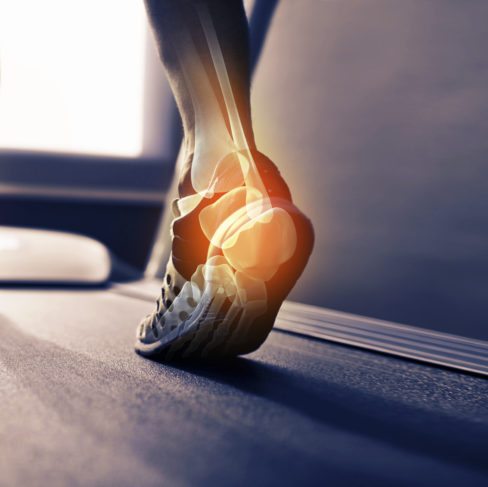 Physiothérapie sportive